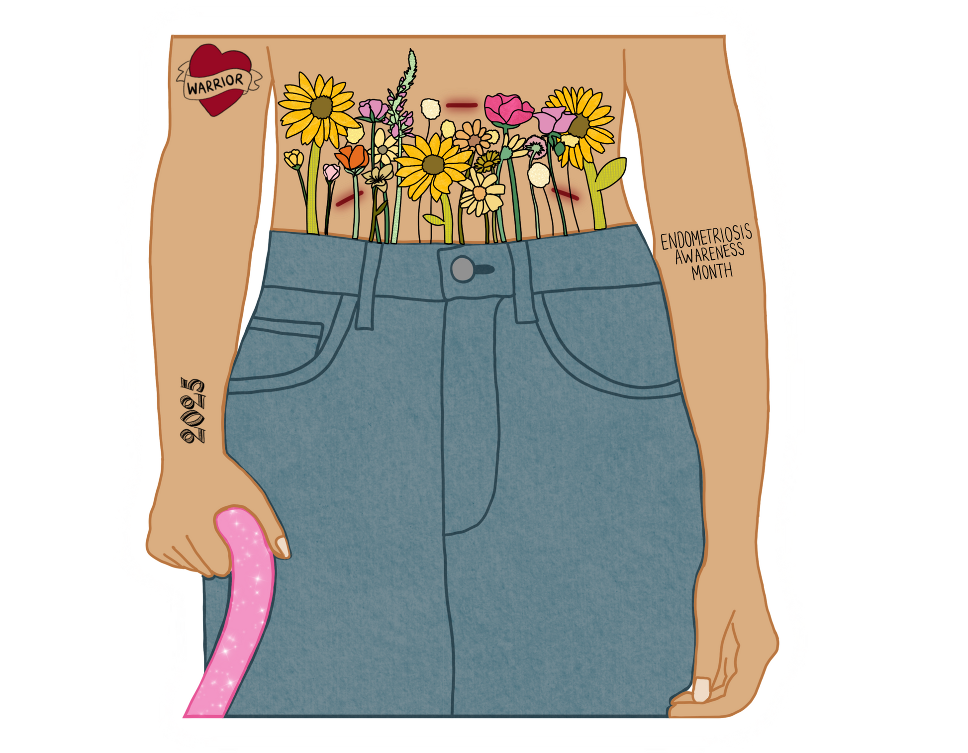 Torso of a person with flowers coming out of their jeans, with three endometriosis-related tattoos on their arms.